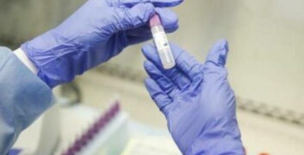 ΕΟΔΥ: Πού θα πραγματοποιηθούν rapid tests σήμερα