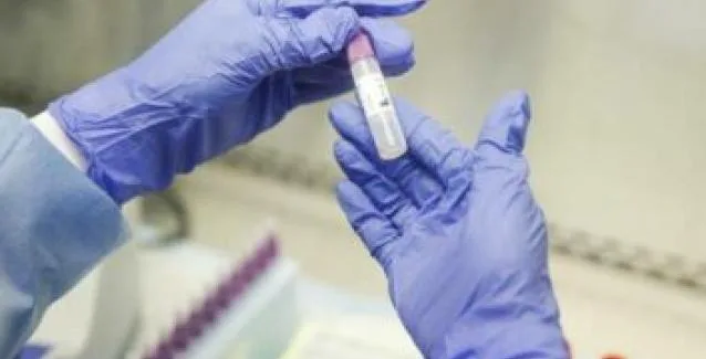 ΕΟΔΥ: Πού θα πραγματοποιηθούν rapid tests σήμερα