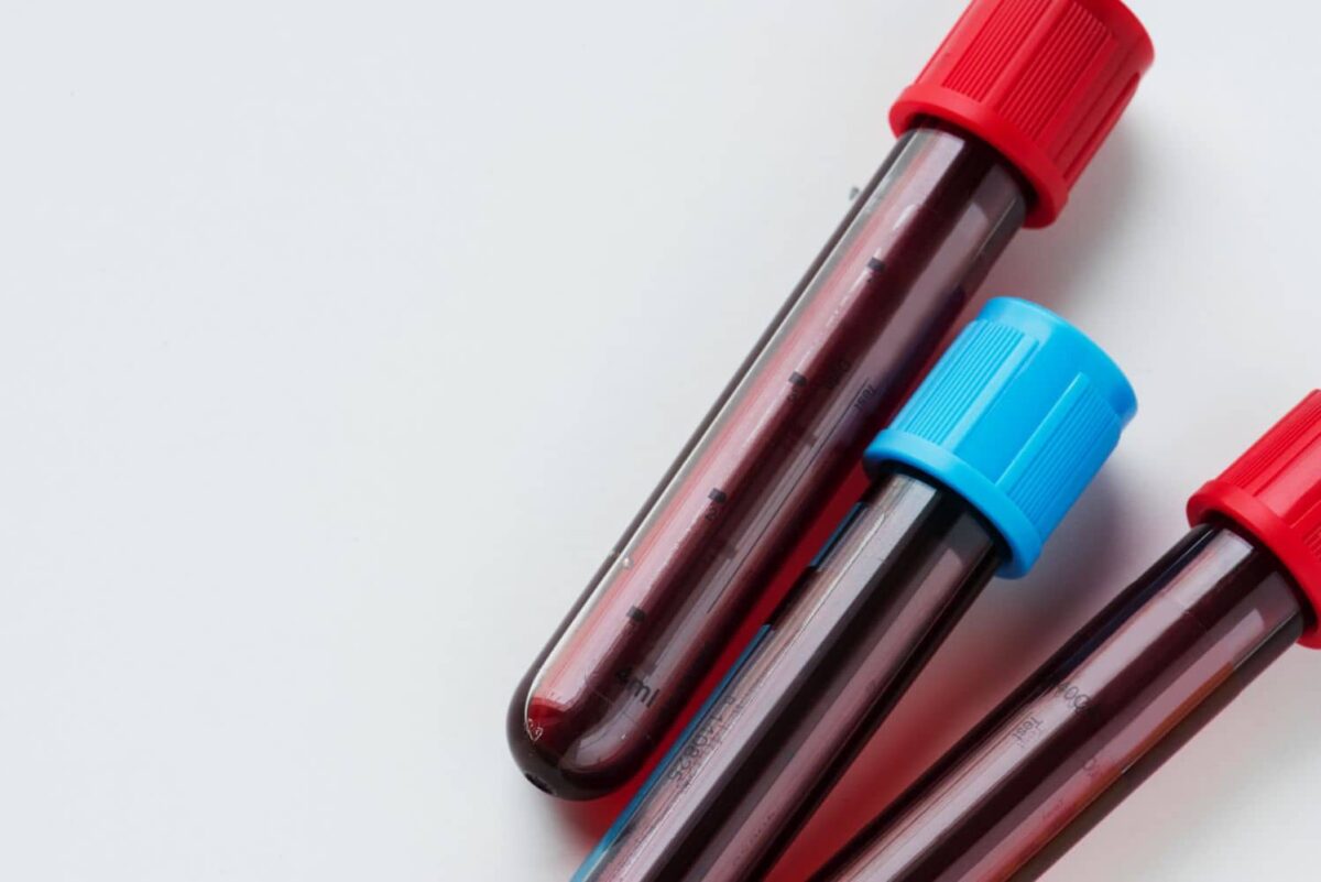 ΕΚΠΑ: Τι ισχύει στην Ελλάδα για τον κορoνοϊό και την αιμοδοσία