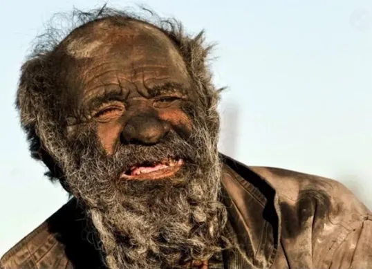 Πέθανε ο «πιο βρόμικος άνθρωπος στον κόσμο» – Πόσα χρόνια είχε να πλυθεί